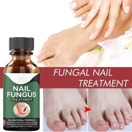 Fast Nail Fungal Treatments Nail Repair Essences Serum Care Treatments Foot Nail Fungus Removal Gel